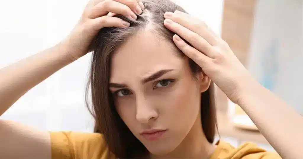 تفاوت ریزش موی ارثی و هورمونی و محصولات مؤثر در تقویت و پیشگیری از ریزش مو 115 تفاوت ریزش موی ارثی و هورمونی