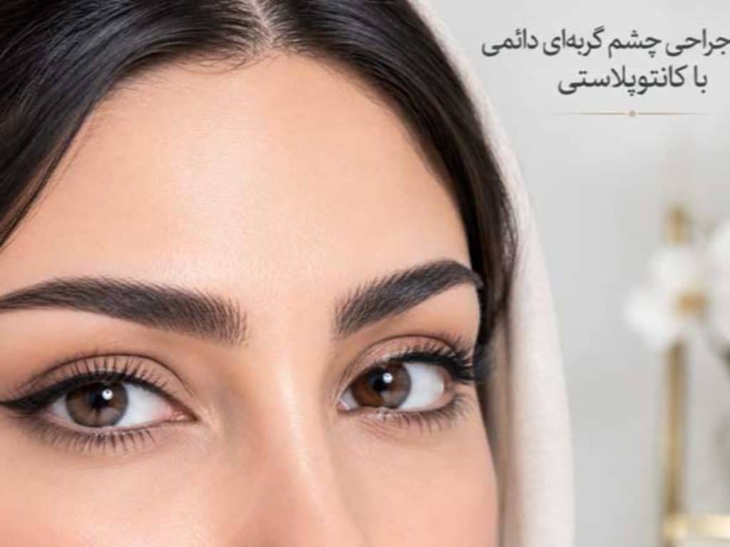 جراحی چشم گربهای دائمی با کانتوپلاستی؛ بررسی جامع تکنیکها، نتایج و ماندگاری 1 جراحی چشم گربه ایی دکتر حیدری