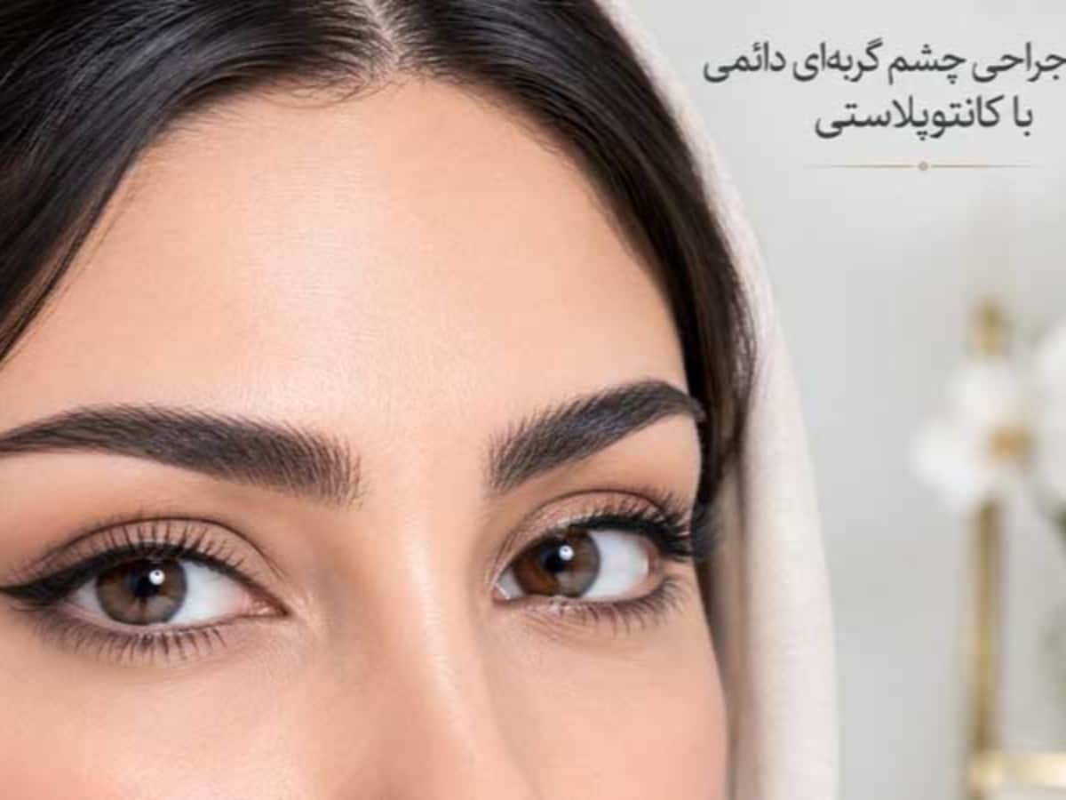 جراحی چشم گربه ایی دکتر حیدری